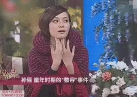 娘娘 孙俪自曝整容?原来是用土法夹鼻子