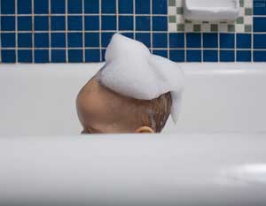 新生儿乳痂症状和护理方法